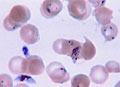malaria-cellule